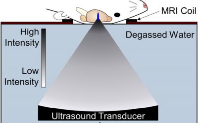3aBA – Using Ultrasound to Deliver Nanomedicine for the Treatment of Parkinson’s Disease – Richard J. Price