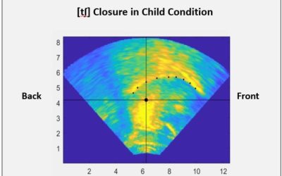 2aSC11 – Adult imitating child speech: A case study using 3D ultrasound – Colette Feehan