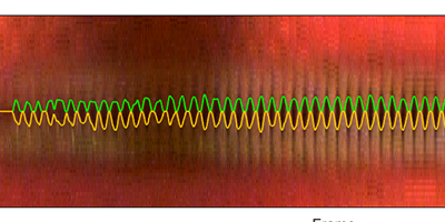 2aSC3 – Studying Vocal Fold Non-Stationary Behavior during Connected Speech Using High-Speed Videoendoscopy – Maryam Naghibolhosseini